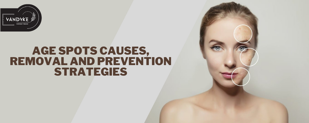 Age Spots Causes, Removal and Prevention Strategies | Vandyke