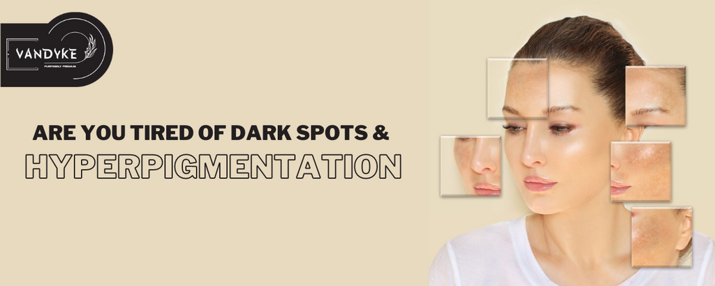 Are You Tired of Dark Spots and Hyperpigmentation?