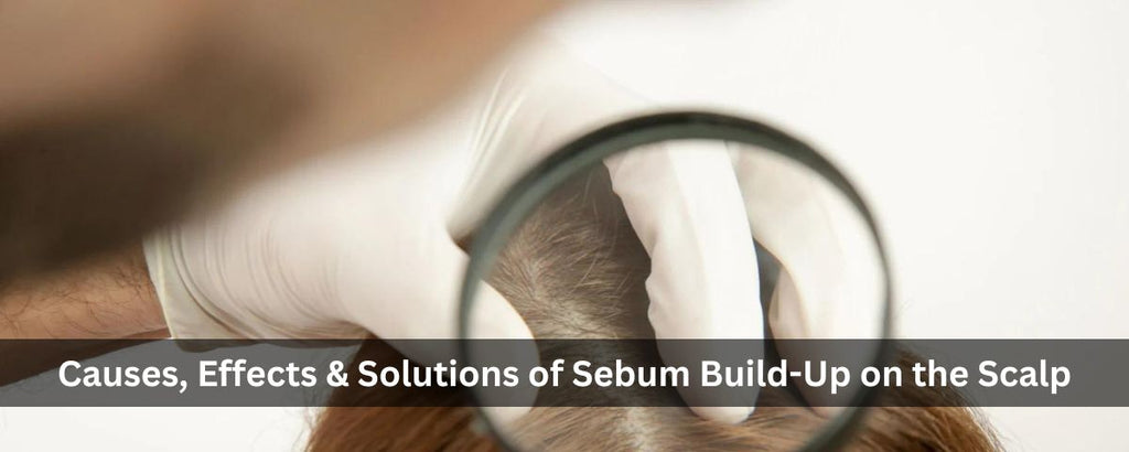 Causes, Effects, and Solutions of Sebum Build-Up on the Scalp