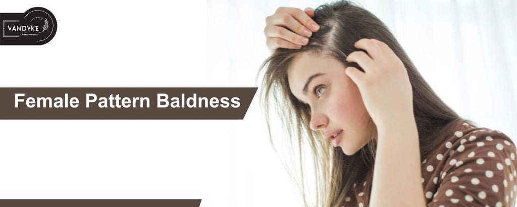 Female Pattern Baldness Recognizing the Early Signs