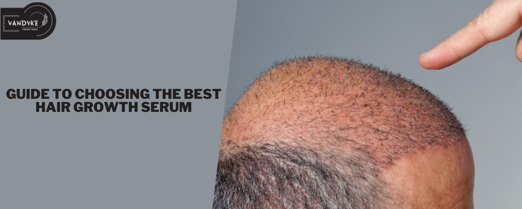 Guide to Choosing the Best Hair Growth Serum: Hair Serum 18%