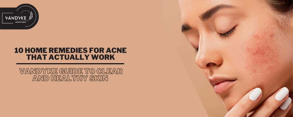 10 Home Remedies for Acne That Actually Work | Guide to Clear and Healthy Skin