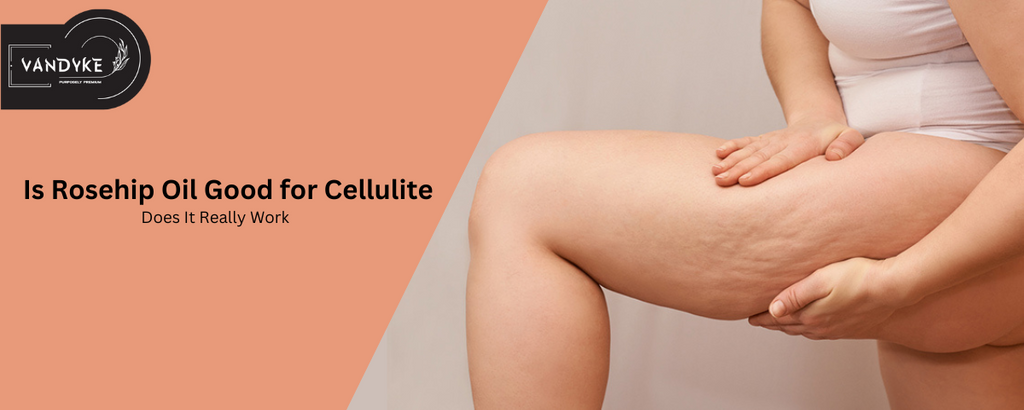 Is Rosehip Oil Good for Cellulite Does It Really Work