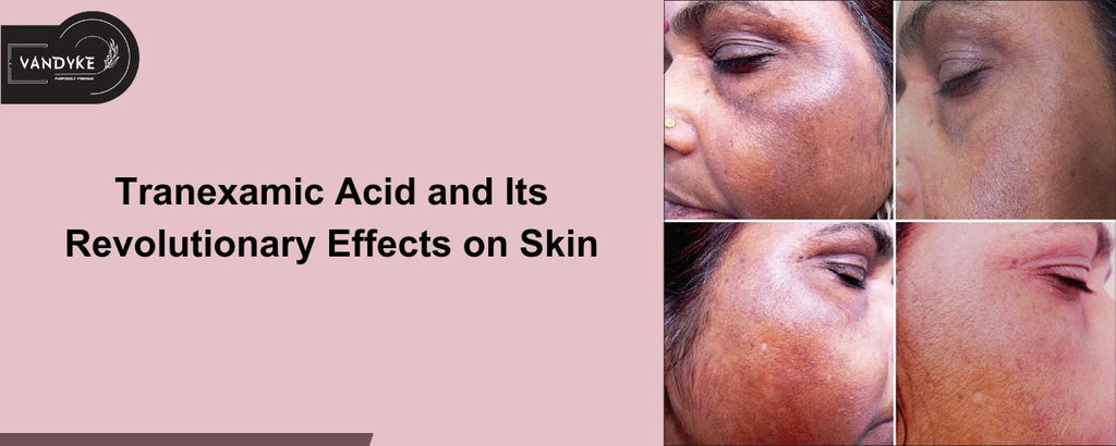 Tranexamic Acid and Its Revolutionary Effects on Skin