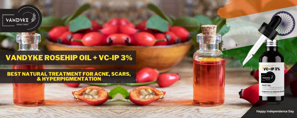 Vandyke Rosehip Oil + VC-IP 3%: Best Natural Treatment for Acne, Scars & Hyperpigmentation