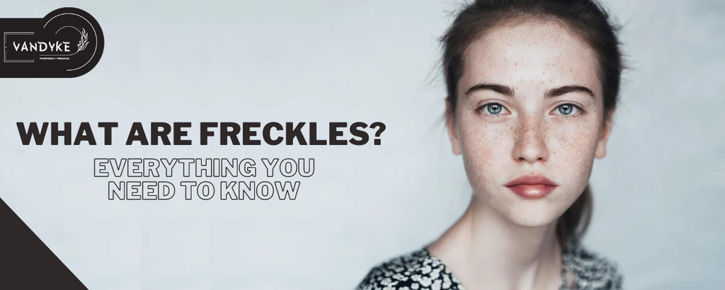 What Are Freckles | Everything You Need to Know