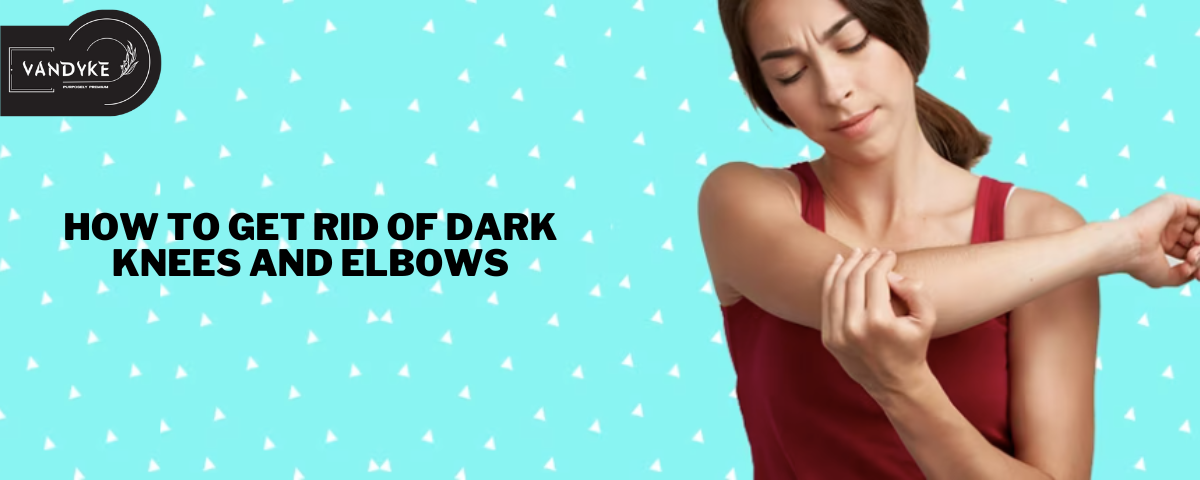How to Get Rid of Dark Knees and Elbows - vandyke