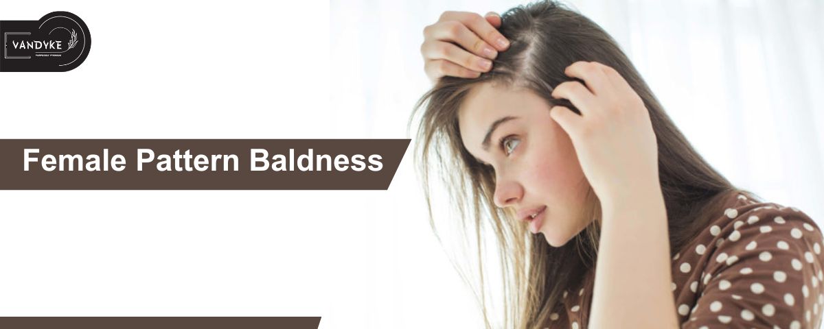 Female Pattern Baldness - Vandyke Hair Growth Actives 18%
