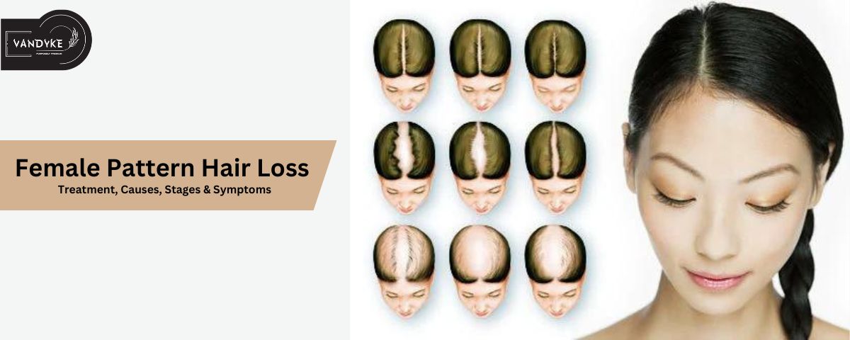 Female Pattern Hair Loss Treatment, Causes, Stages & Symptoms - Hair Growth Actives 18%