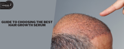 Guide to Choosing the Best Hair Growth Serum - Vandyke